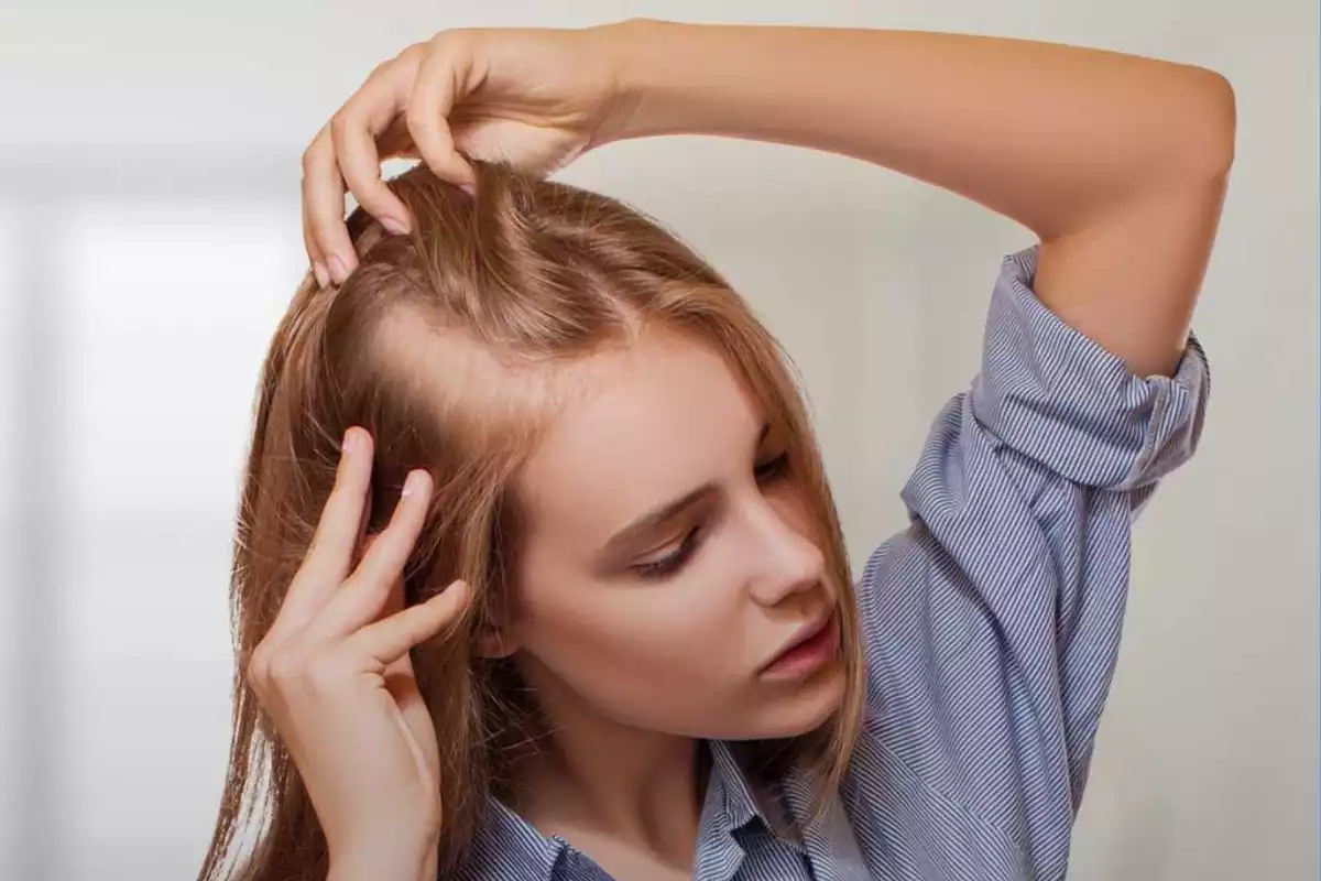 Explore The Best Hair Extensions For Alopecia